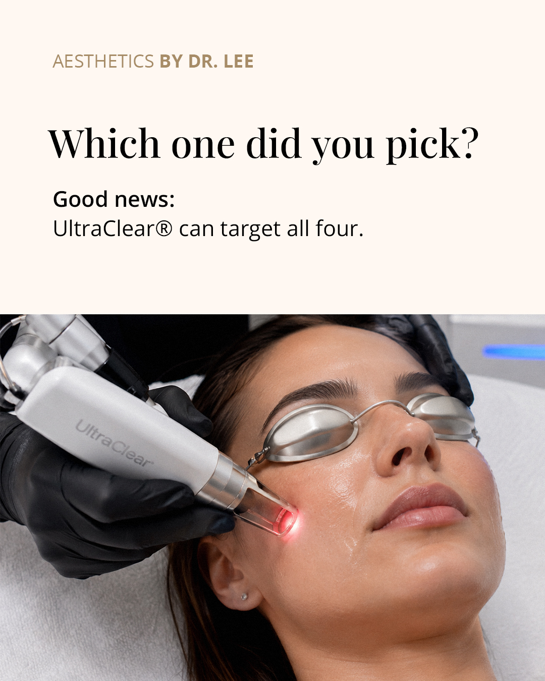 UltraClear laser skin resurfacing treatment